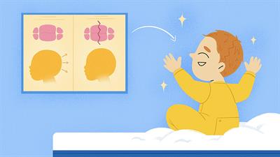 How Can Surgery Correct Infant Head Shapes?